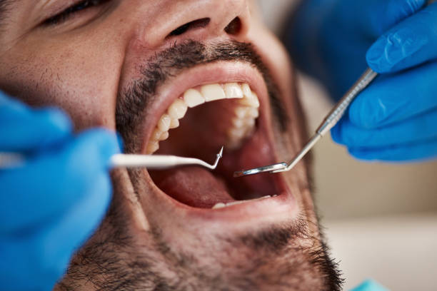 Best Emergency Dental Surgery in El Paso, IL
